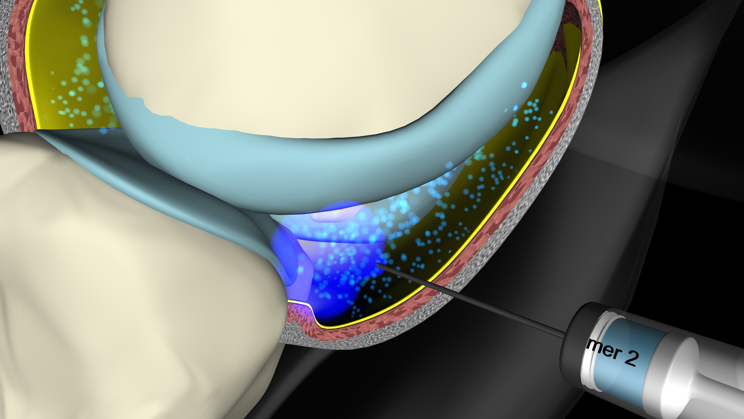 RenehaVis – Wirksame Hyaluron-Kombination